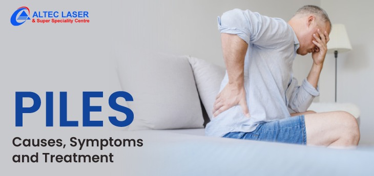 Piles causes, symptoms and treatment